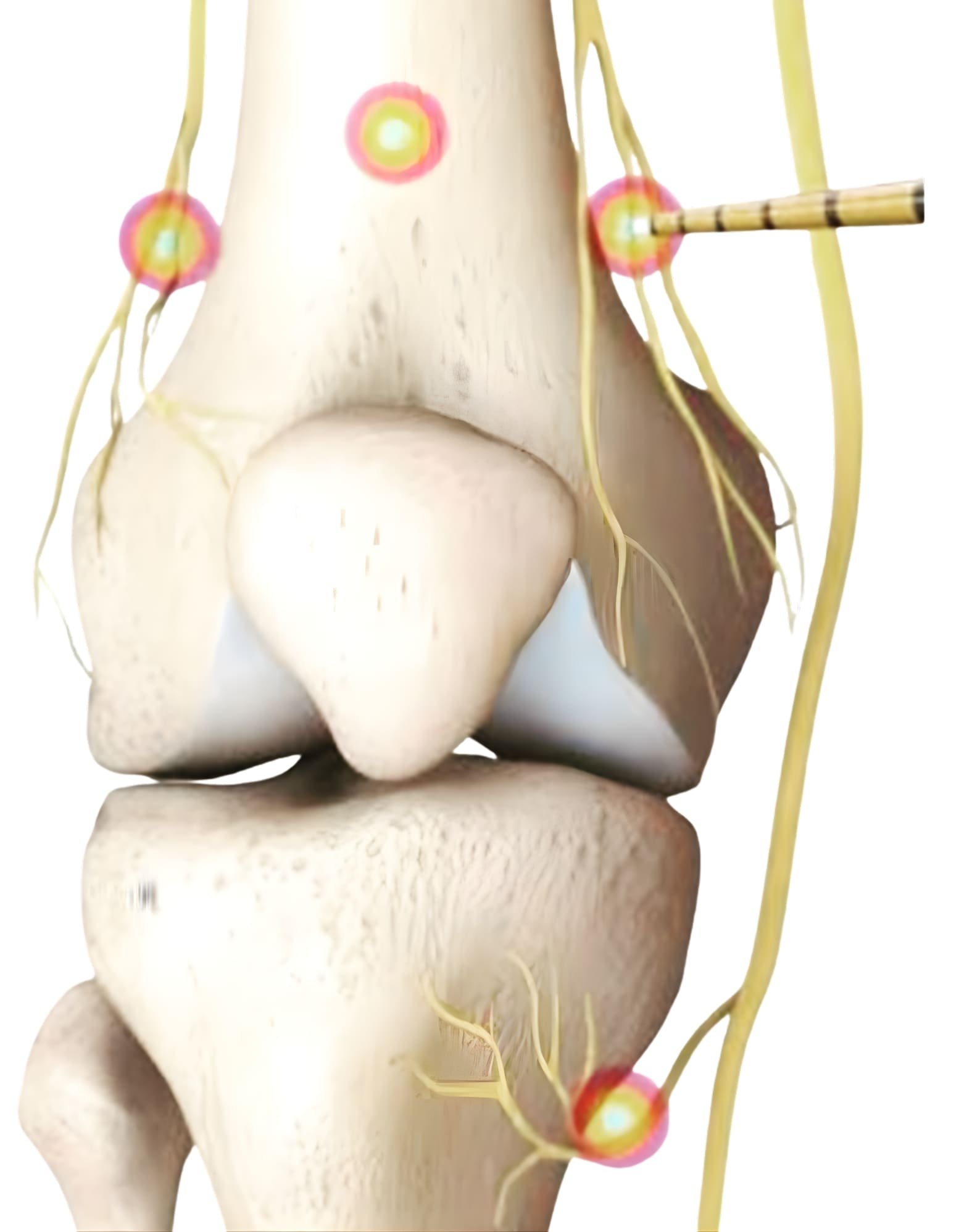 Procedimento Ortopédico
